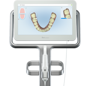 iTero Imaging for Invisalign Clear Braces - Endres Gateway Dentistry Montgomery OH