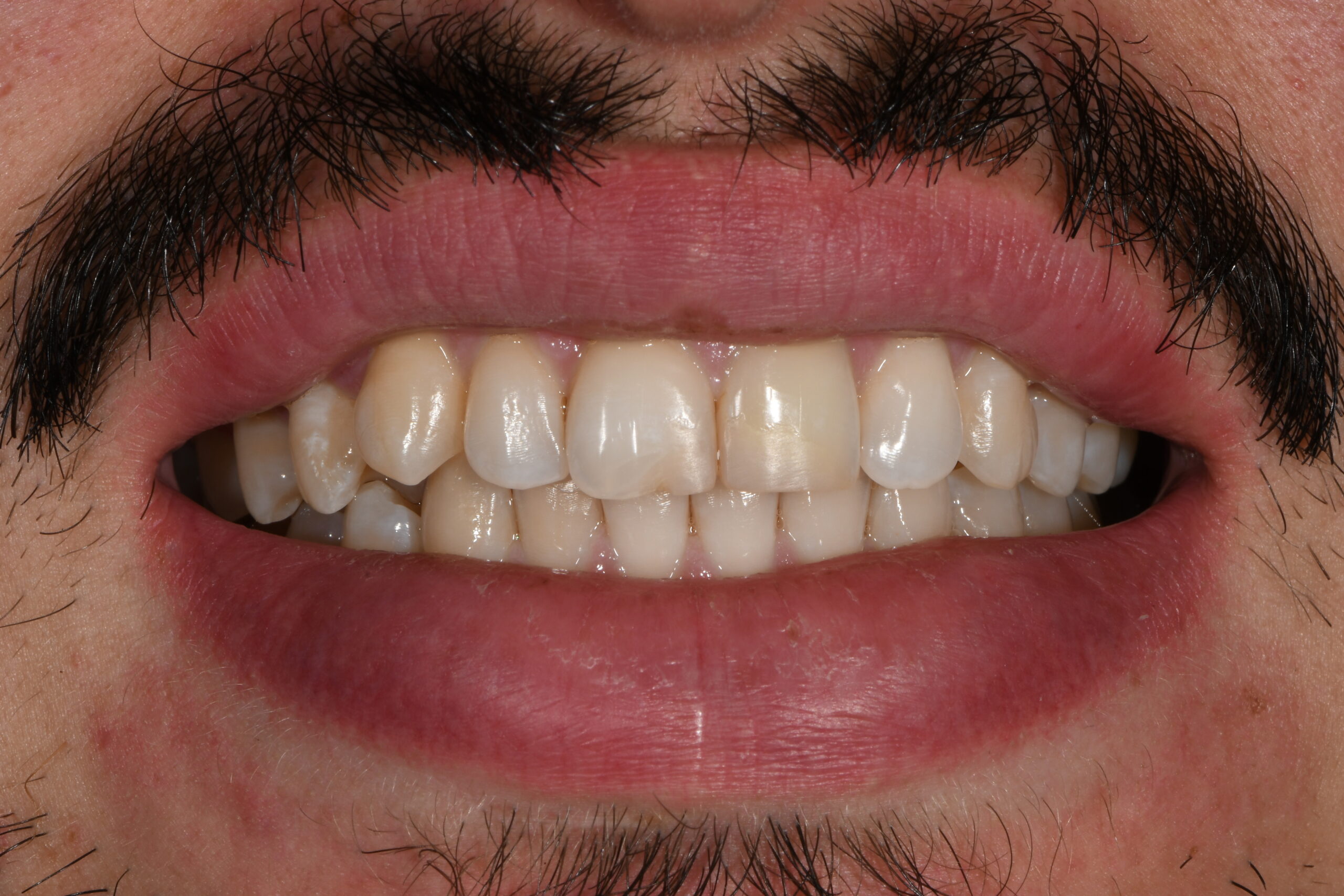 Gabriel David - Before cosmetic dental treatment