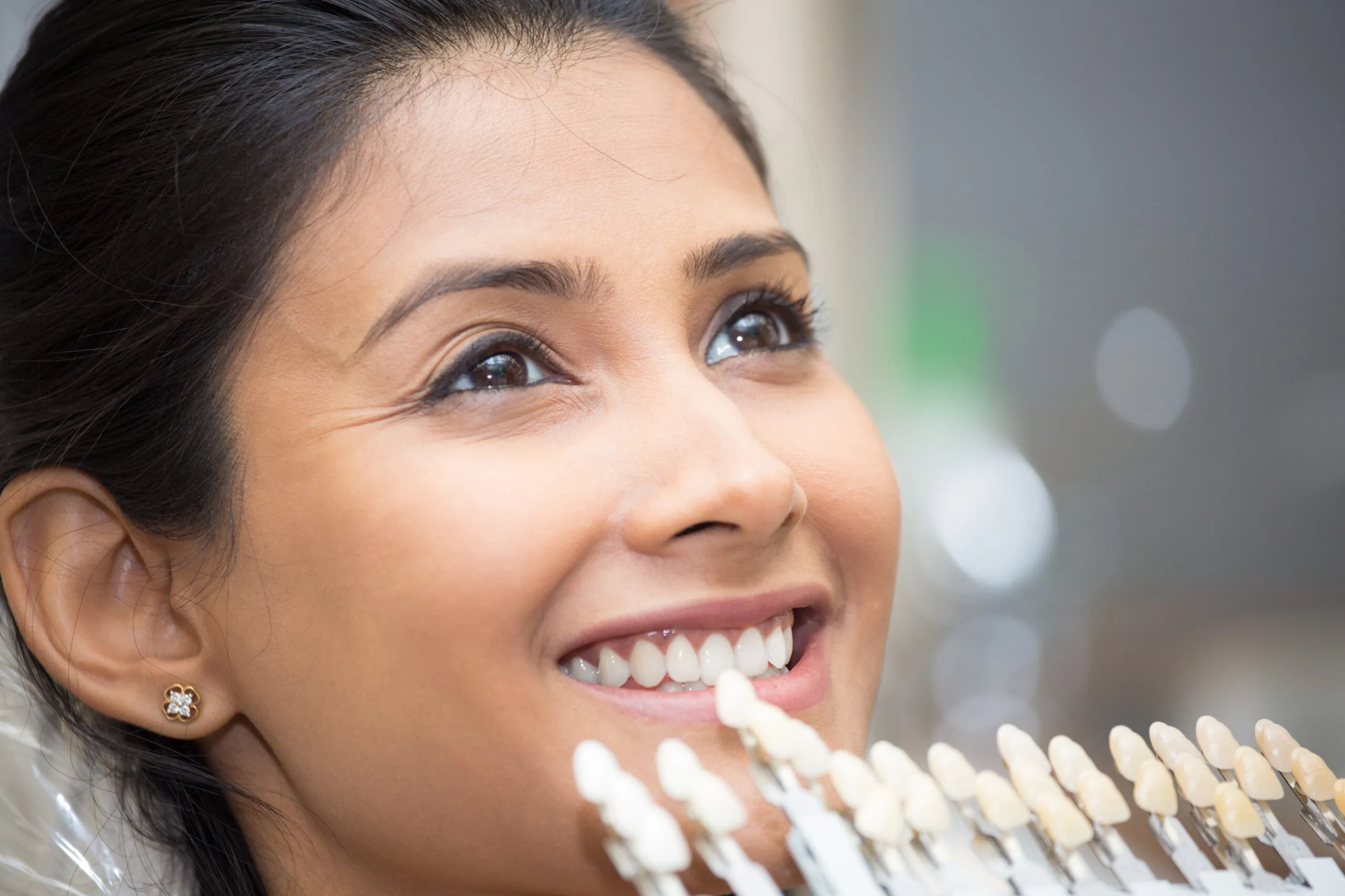 Patient undergoing the porcelain dental veneer color matching process in Montgomery, OH.